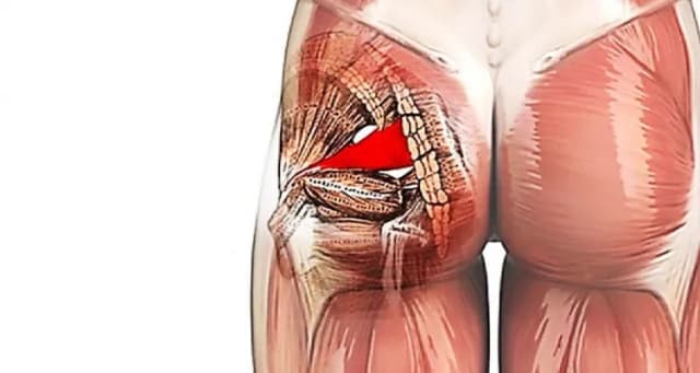 Dolor en el músculo piramidal: causas, síntomas y tratamientos efectivos Dolor en el músculo piramidal: causas, síntomas y tratamientos efectivos