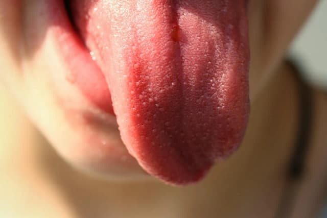 Músculos de la lengua: funciones esenciales y su impacto en el habla Músculos de la lengua: funciones esenciales y su impacto en el habla